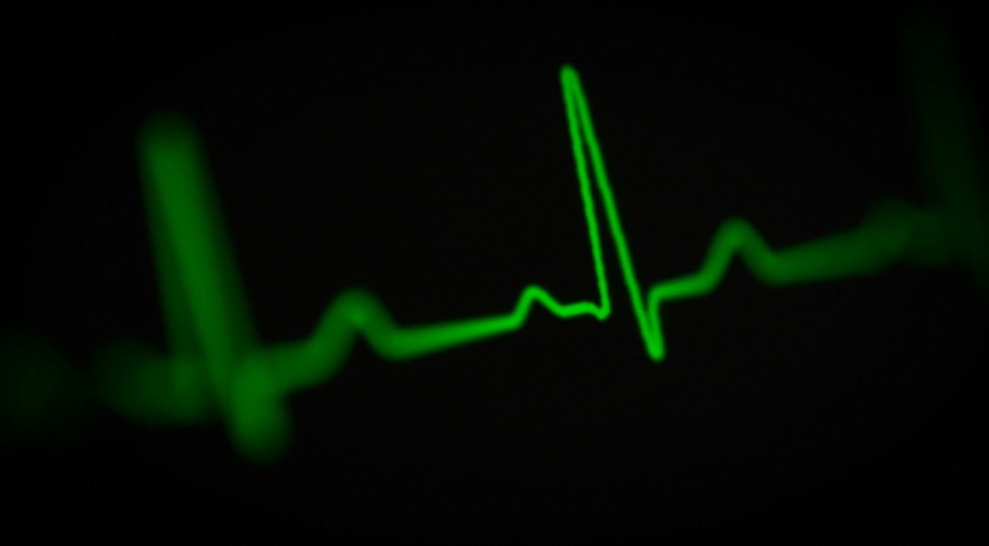 12-lead EKG trace on a monitor