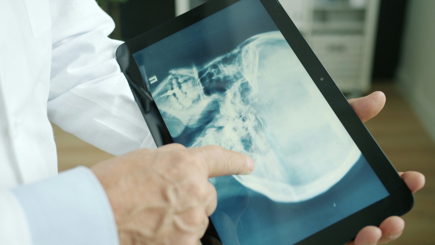Digital X-Ray reviewed on a tablet